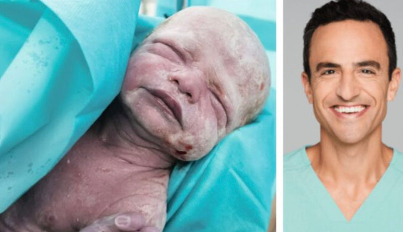 Bounty Parents interview Dr Golly | It’s normal for your baby to look a bit like an alien